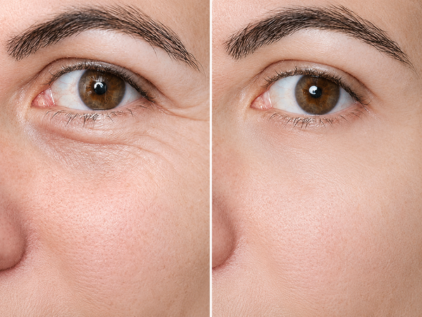 My esthetician noticed the difference